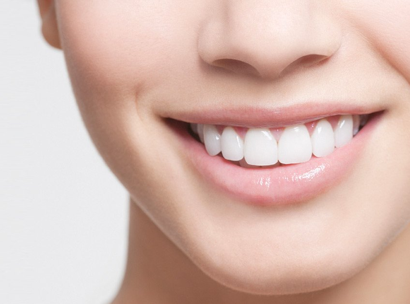 WHAT IS A SMILE MAKEOVER?